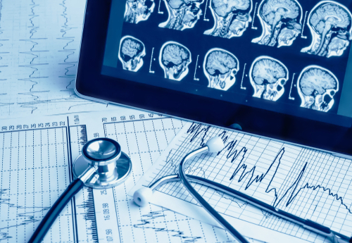 What is a Mesothelioma Lawyer: NC Mesothelioma Law